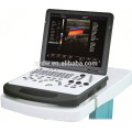 preço baixo ultra-som portátil do ultra-som doppler da cor 906w de alta qualidade com apoio laboral a longo prazo